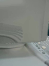 ซินเดอเรลล่ากลับมาล้างแค้น - Episode 71