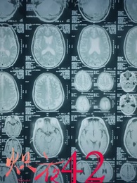 Addicted To Her - Episode 42