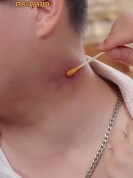 ตอนที่ 47 - รักตัวเองดีที่สุด