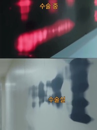 10화 - 오버도즈