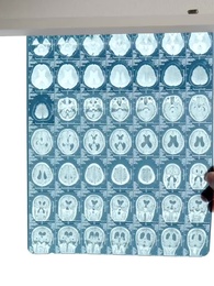 第7集 - 我的最後一任男朋友