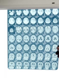 Drowning in Lost Love - Episode 7