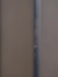 17화 - 기생충과의 동거