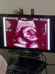 Mme Mère Porteuse du Milliardaire - Episode 1