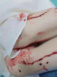 걷잡을 수 없는 사랑 - Episode 65