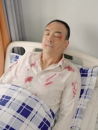 第71集 - 巔峰狂醫