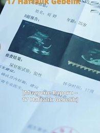 Ailenin Onuru - Episode 29