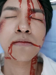 醫武狂婿 - Episode 2