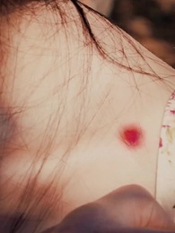 第5集 - 絕品小村醫