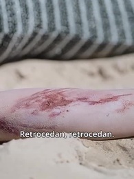 Episodio 2 - Pistas de Sangre