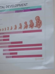 The Double Life of a Billionaire’s Sweet Ex-wifey - Episode 63