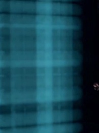 The 101st Divorce: Her Final Farewell - Episode 2