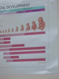 Plan Secret : Reconquérir Mon Propre Époux - Episode 63