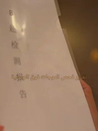 الحلقة 21 - الأحمق الذي احتوى قلبي