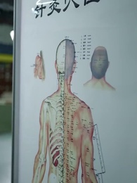 転科の果て 復讐の針 - Episode 15